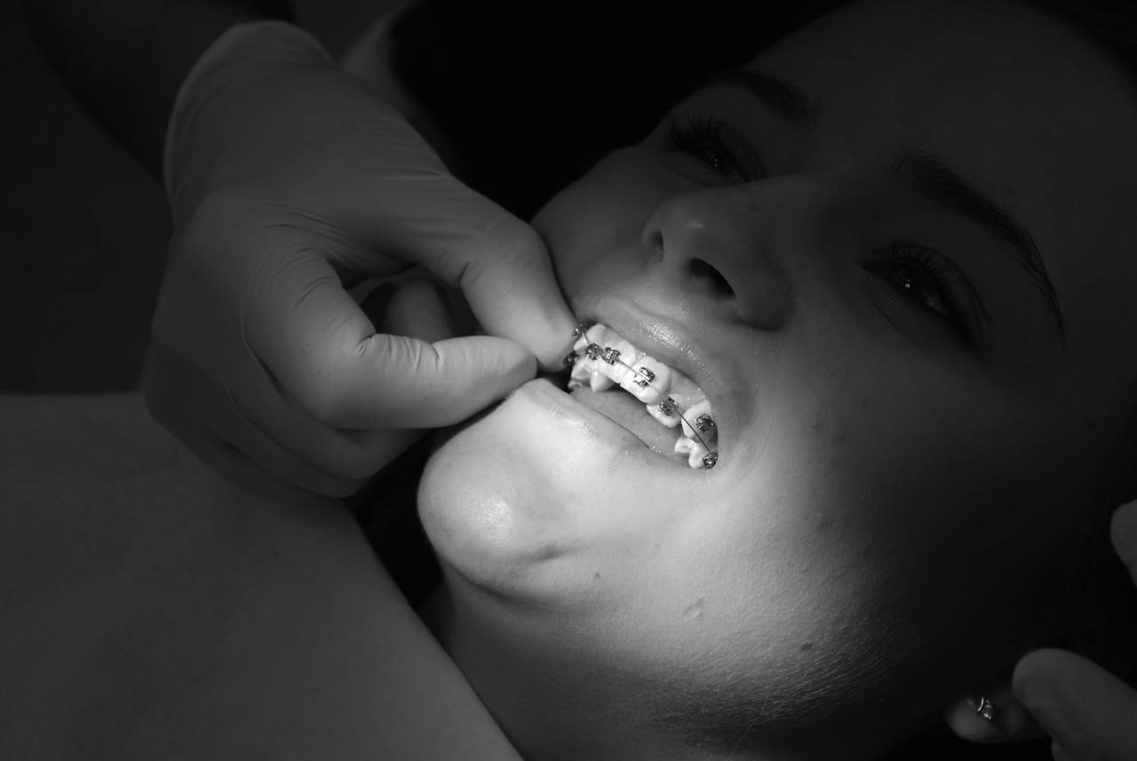 Fingre, der retter bøjle