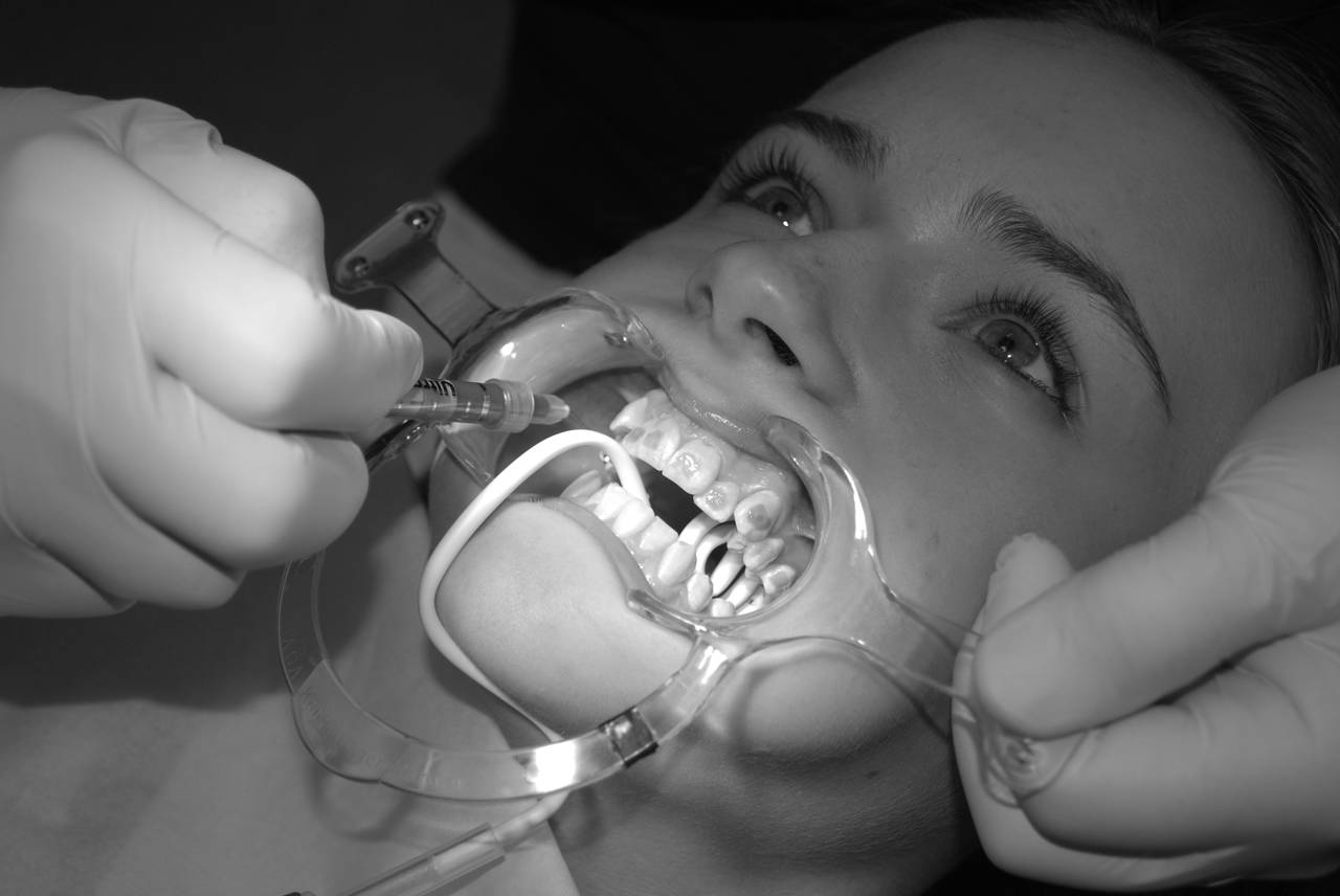 Påsætning af bøjle