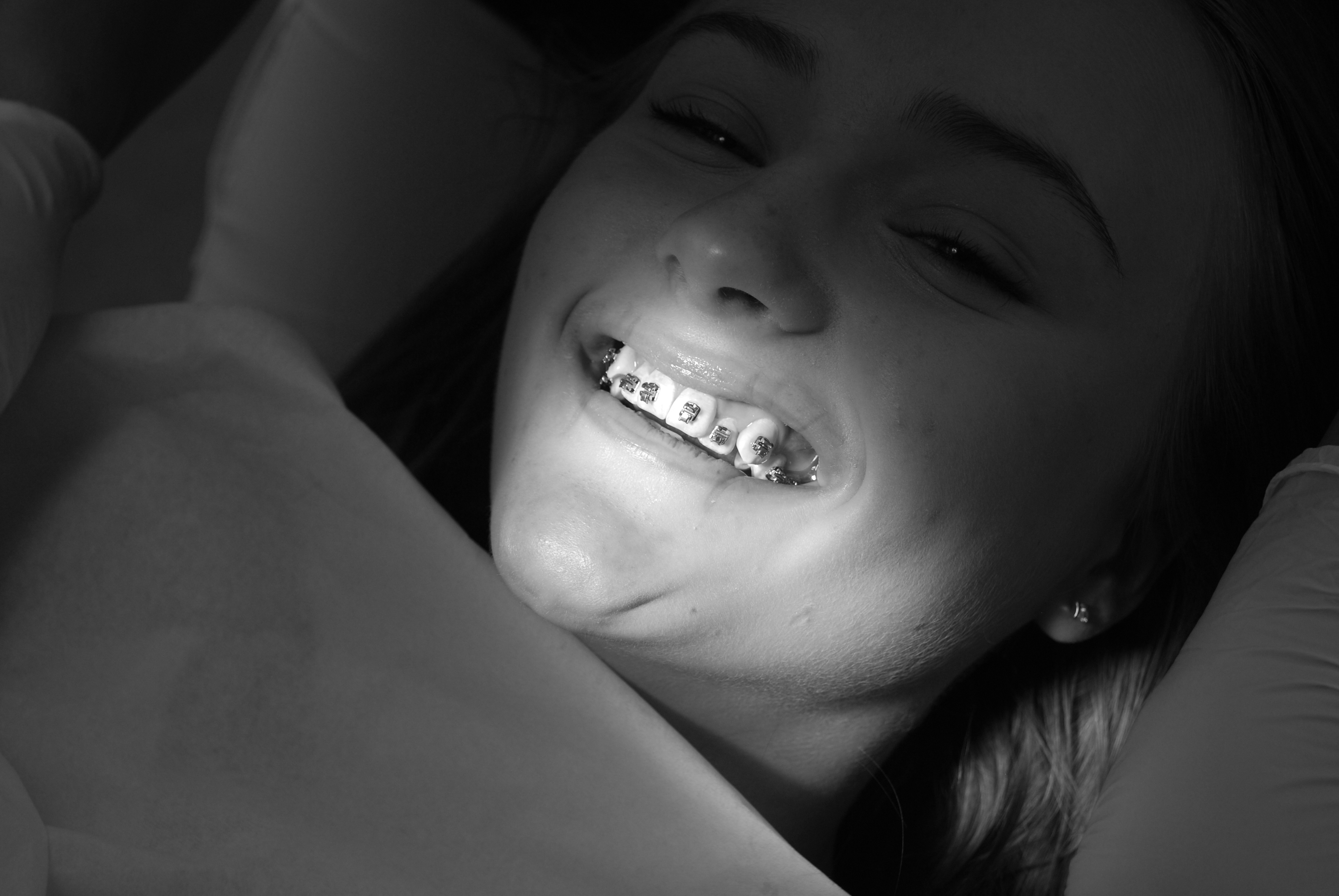 Smil med bøjle på tænder