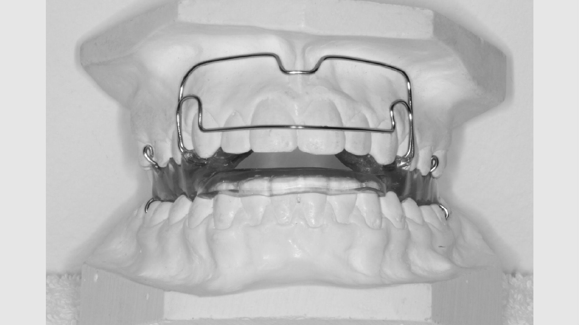 Bøjle på gipsafstøbning